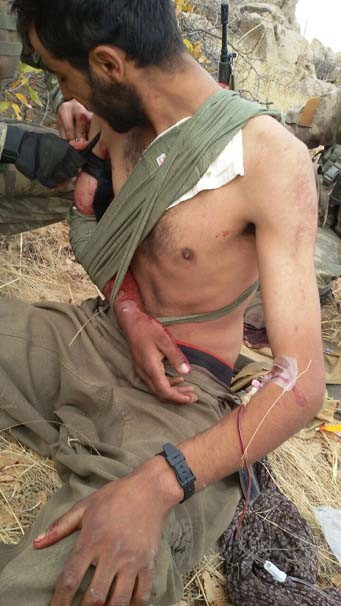 Asker PKK'lı yaralı bulunca bakın ne yaptı? - Resim: 2