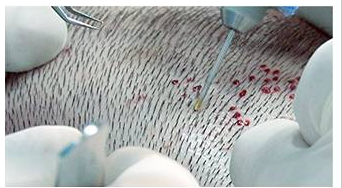 Aslında bu ünlülerin hepsi kel - Resim: 3