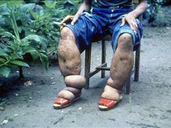 Allah düşmanımızın başına vermesin! - Resim: 1