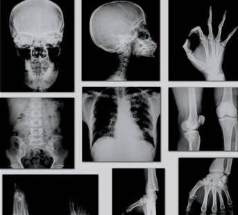 Çok sıkıştığınızda seks düşünün - Resim: 1