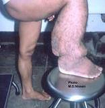 Allah düşmanımızın başına vermesin! - Resim: 3