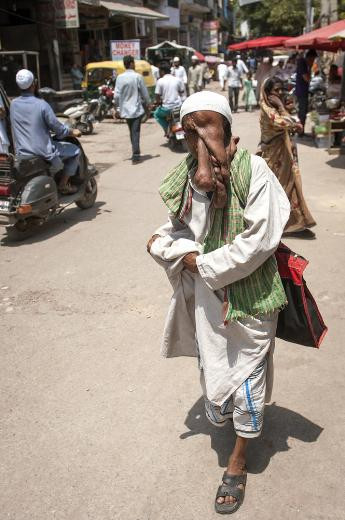 Fil adam ameliyatı reddetti - Resim: 3