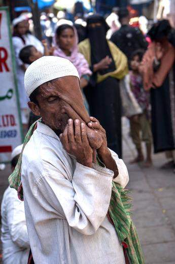 Fil adam ameliyatı reddetti - Resim: 4