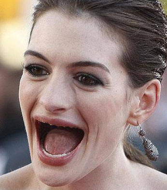 Hollywood güzellerinin dişsiz halleri! - Resim: 1