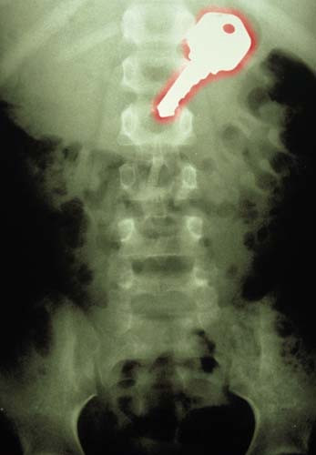 Bu röntgenler gerçek! - Resim: 4