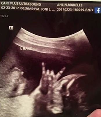 Bebeğin yanında bir de kedi bekliyorlar - Resim: 1