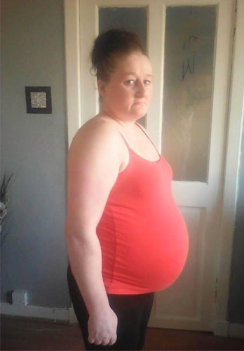 Hamile değil karnındaki şey mide bulandırıcı! - Resim: 1