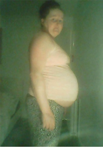 Hamile değil karnındaki şey mide bulandırıcı! - Resim: 2