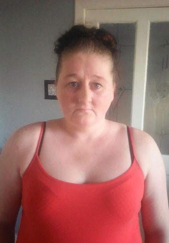 Hamile değil karnındaki şey mide bulandırıcı! - Resim: 3