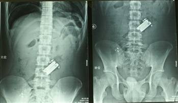 Bunlara siz bile inanamayacaksınız! - Resim: 1