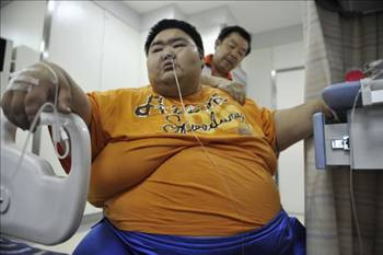 İşte Çin'in en şişman adamının zor anları - Resim: 2