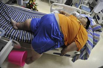 İşte Çin'in en şişman adamının zor anları - Resim: 4