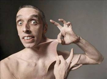 50 cm'lik zinciri önce yutuyor sonra kusuyor - Resim: 4