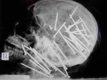 Bunlara siz bile inanamayacaksınız! - Resim: 3