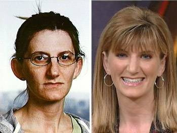 Zorla güzellik olmaz demeyin! - Resim: 1