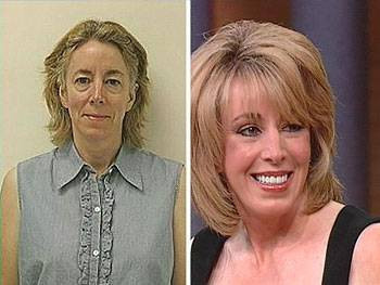 Zorla güzellik olmaz demeyin! - Resim: 3