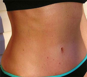 Dümdüz bir karına sahip olmanın formülü - Resim: 4