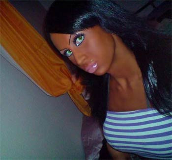 Silikon yaptırınca bu hale geldiler - Resim: 3