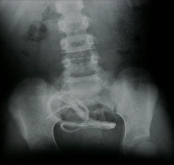 Türklere nasip ölümler - Resim: 1