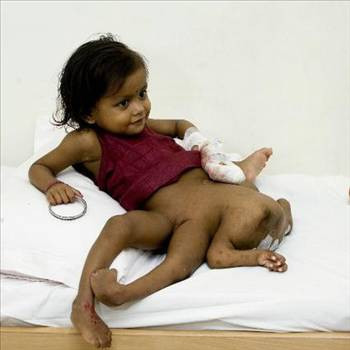 Onların yaşama tutunması bir mucize! - Resim: 4