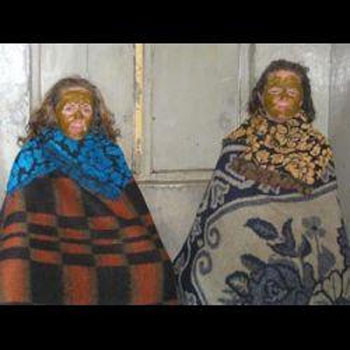 Güzellik uğruna bu yöntemleri siz kullanırmısınız? - Resim: 4