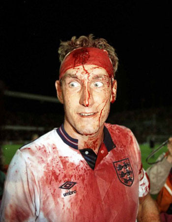 İşte sporda hafızadan silinmeyecek anlar - Resim: 4