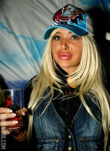 Silikon yaptırınca bu hale geldiler - Resim: 2