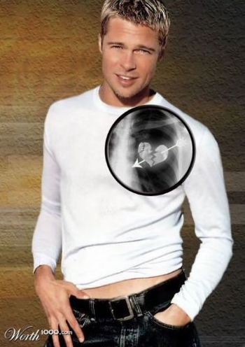 İnanılmaz Xray görüntüleri - Resim: 1