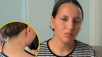 Mersin'de 3 çocuk annesi talihsiz kadın bıçakla yaralayan eşinin cezalandırılmasını istiyor...