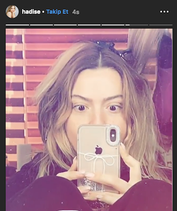 O Ses Türkiye jürisi Hadise'den cesur paylaşım makyajsız haliyle...  - Resim: 2