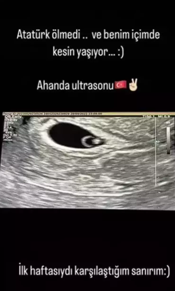 Gonca Vuslateri, bebeğinin ultrason görüntüsünü paylaştı: Atatürk benim içimde yaşıyor - Resim: 0