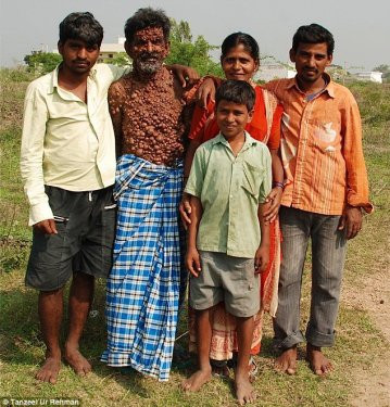 Hastalığı hayatını mahvetti - Resim: 2