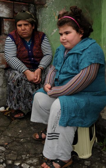 11 yaşında 84,5 kiloya ulaştı - Resim: 3