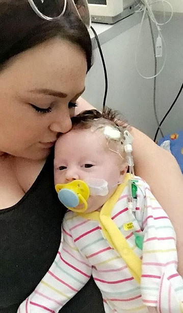 Bu halde dünyaya geldi annesi dehşete düşüp streç filmle... - Resim: 2