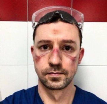 Koronaveirüsle savaşın kahramanları bunlar da kahramanlık izleri - Resim: 1