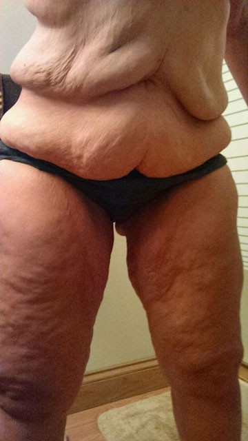 Sarkan derisinden kendine meme yaptırdı! - Resim: 4