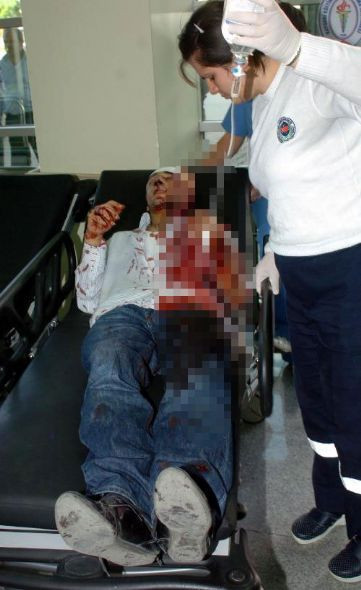 Yan bakma tartışmasına kan bulaştı - Resim: 1