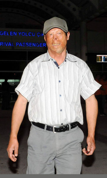 Bu yüze çok dikkatli bakın! - Resim: 3