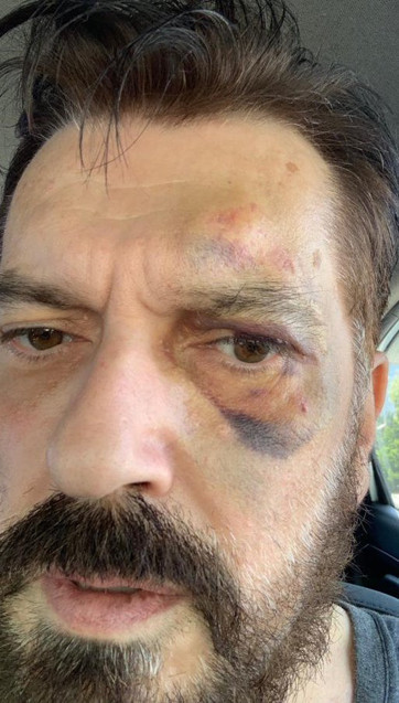 SONAR anketin sahibi Hakan Bayrakçı'yı kim dövdü? İma ettiği isim - Resim: 0