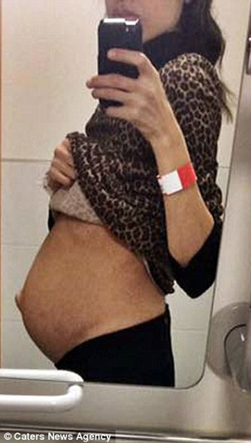 İnanılır gibi değil! 10 yıl boyunca bunu karnında taşımış - Resim: 1