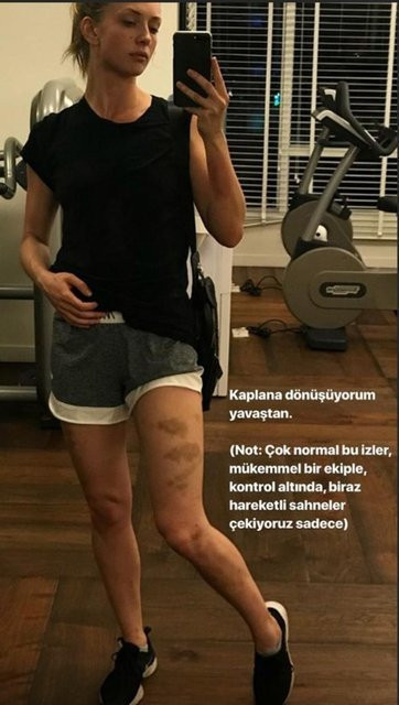 Yasemin Allen'in bacaklarını gören şaşırdı - Resim: 2