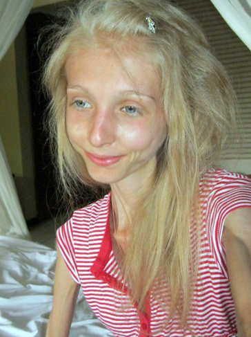 Görüntüsüyle dehşete düşürdü - Resim: 2