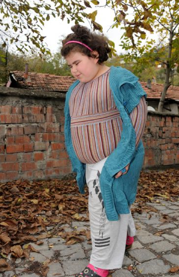 11 yaşında 84,5 kiloya ulaştı - Resim: 4