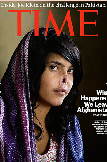 Afgan kızın yeni burnu şaşırttı - Resim: 3