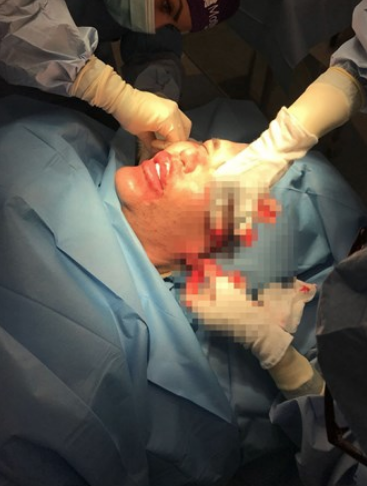 60 kez operasyon geçirdi doktorları dinlemedi! Son hali olay - Resim: 3