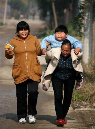 2 yaşında 45 kilo ağırlığa ulaştı - Resim: 1