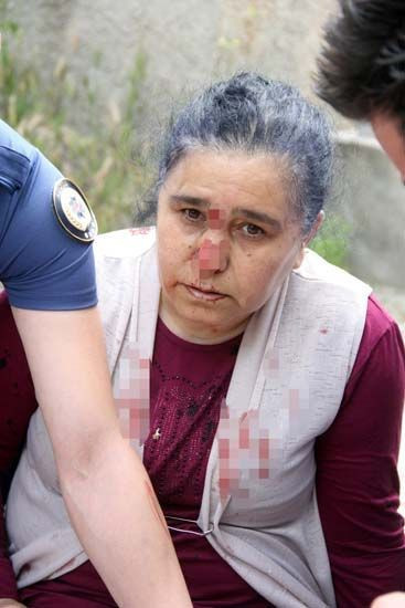 Babası annesini vurdu ambulansın peşinden ''anne'' diyerek koştu - Resim: 1