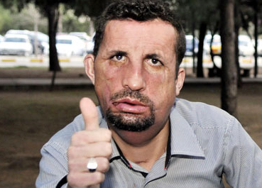 Uğur Acar'ın son hali şoke etti - Resim: 4