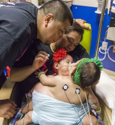 ABD'de yapışık ikizler ameliyatla ayrıldı - Resim: 4