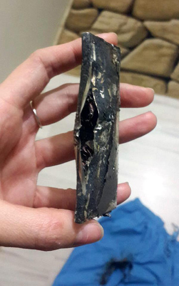 Hasta muayene ederken cebindeki telefon patladı! - Resim: 4